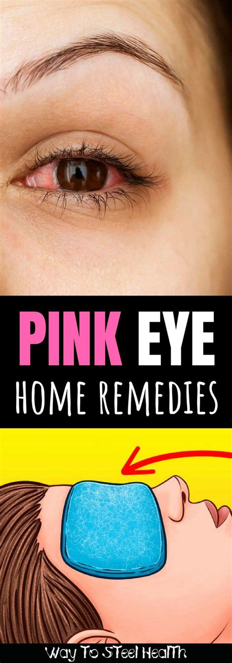 Get rid of pink eye fast with these 6+ home remedies | Natural pink eye ...