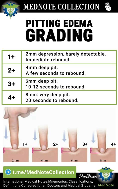 Pitting Edema Levels