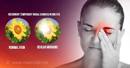 Ocular Migraine Blind Spot