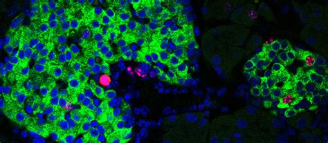 Circadian rhythms drive beta cell regeneration