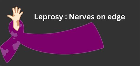 Types of nerve damages due to leprosy - Happiest Health