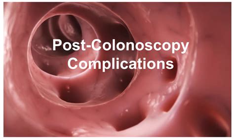 emDOCs.net – Emergency Medicine EducationPost-Colonoscopy Complications - emDOCs.net - Emergency ...