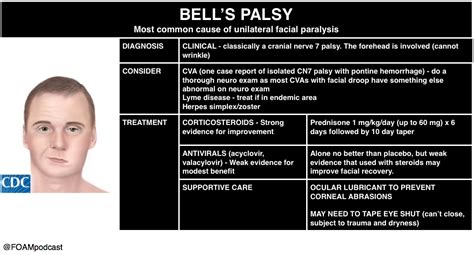 Bell’s Palsy and Burns – FOAMcast