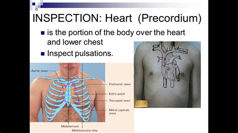 Precordium Inspection for signs of cardiovascular system diseases - YouTube