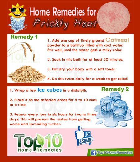 Home Remedies For Heat Rash - Riset