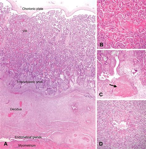 —Histology of the normal macaque placenta. (A) Full-thickness section ...