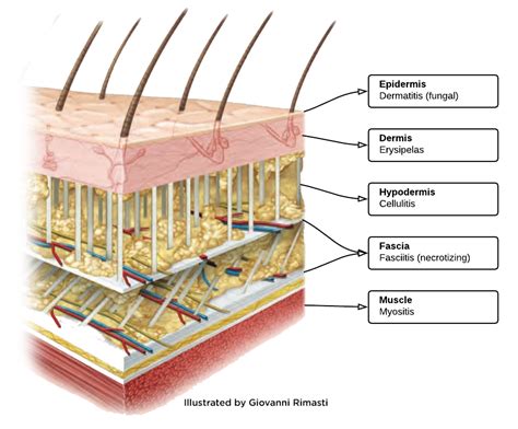 Hypodermis Layer