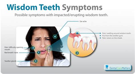 Wisdom Teeth Pain and Common Symptoms That Arise