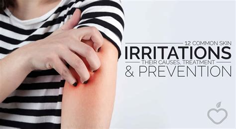 12 Common Skin Irritations: Their Causes, Treatment and Prevention ...