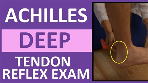 Deep Tendon Reflex Assessment Scale