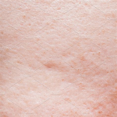 Human face skin texture featuring abstract, acne, and background | People Images ~ Creative Market