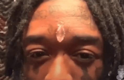 Lil Uzi Vert Explains Why He Got a Diamond Implanted on His Forehead – aGOODoutfit