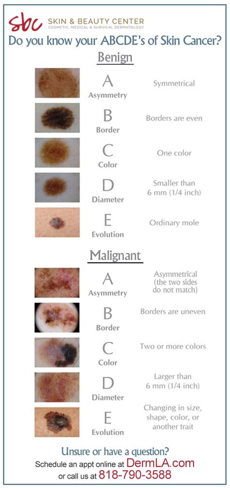 Know your ABC's of Skin Cancer