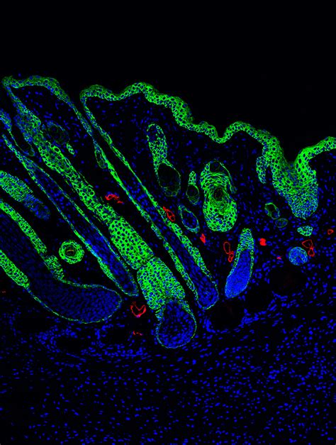 Wound-healing hydrogel reduces scars by triggering immune response