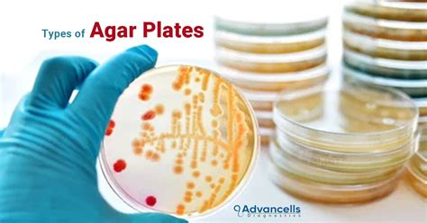 Types of Ready To Use Agar Plates | Advancellsdiagnostics