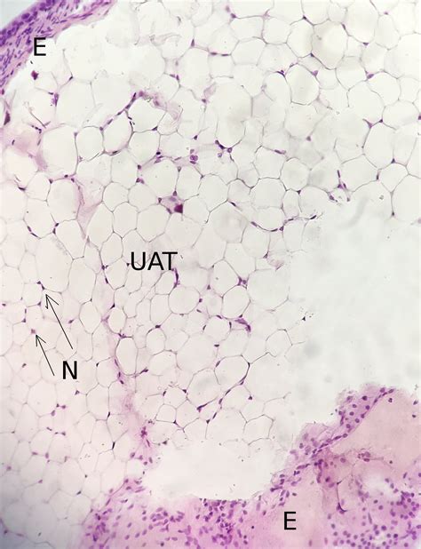 Unilocular Adipose Tissue 20x | Histology