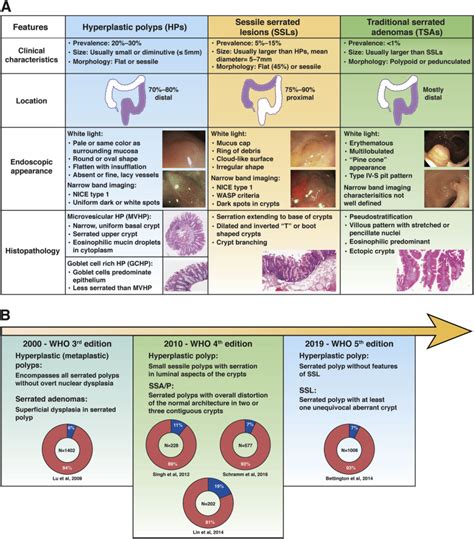 Terminology, Molecular Features, Epidemiology, and Management of Serrated Colorectal Neoplasia ...