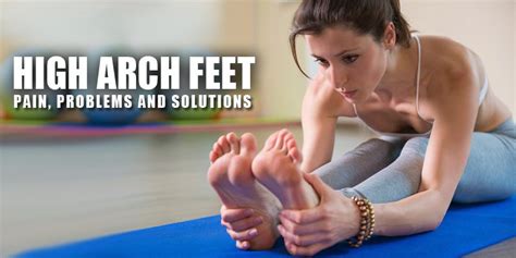 What Are High Arch Feet? Causes & Solutions