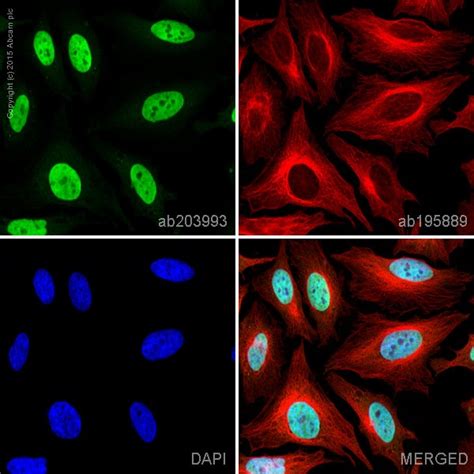 Alexa Fluor® 488 Anti-NuMA antibody [EP3976] (ab203993) | Abcam