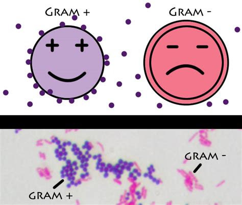 Gram Positive vs Gram Negative Bacteria Simplified – DBriers.com