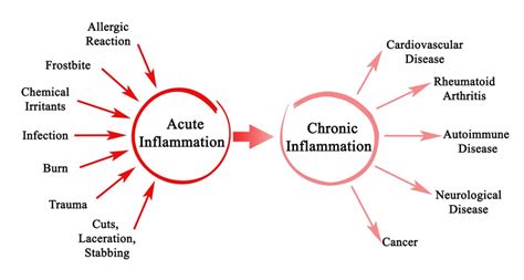 Different types of inflammation Pharmacy Gyan Pathophysiology