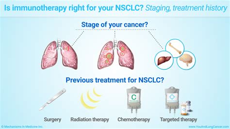 Slide Show - Immunotherapy Treatments for Non-small Cell Lung Cancer (NSCLC)