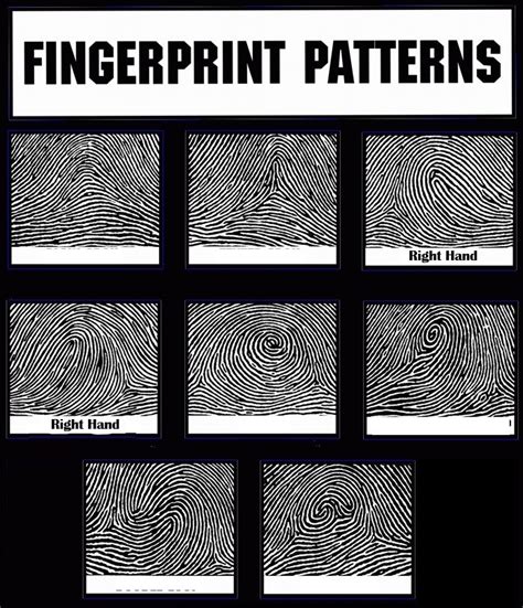 Radial Loop Fingerprint