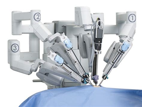 The Robot Assisted Surgery for Epilepsy that Changed on Man’s Life | SurgeryFix