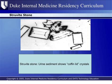 PPT - Kidney Stones PowerPoint Presentation, free download - ID:4643870