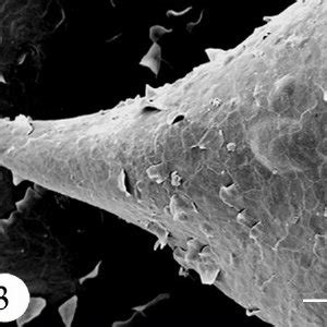 Photomicrograph of the sublingual caruncle showing highly keratinized ...