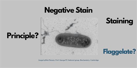 Negative staining procedure, principle, and results