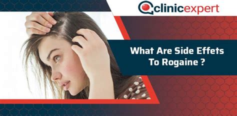 What Are The Side Effects To Rogaine? | ClinicExpert