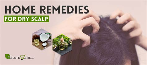 Top 6 DIY Home Remedies For Dry Scalp - Get Rid Of Itchy Scalp!