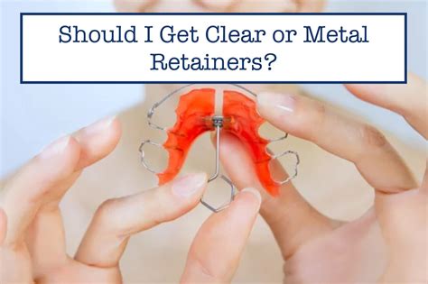 Should I Get Clear or Metal Retainers? – B.WEISS Health