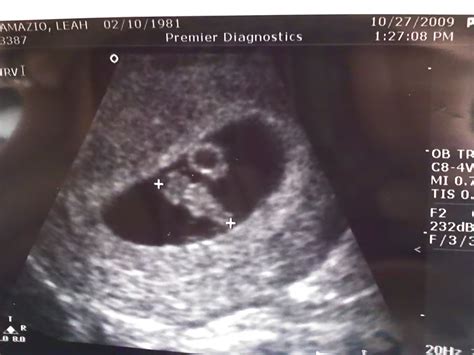 Michael Angelo, my junebug: First Ultrasound! 7 weeks pregnant!