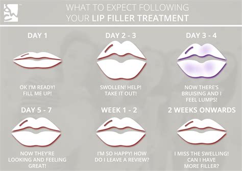 How Will My Lips Feel After Fillers | Lipstutorial.org