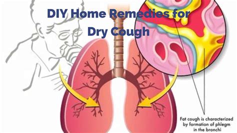 DIY Home Remedies for Dry Cough