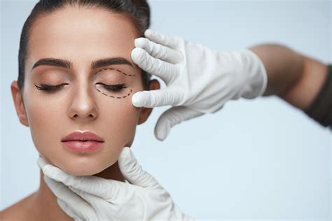 How Eyelid Surgery Restores a Youthful, Wide-Eyed Appearance for Upper ...