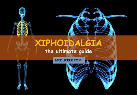 Xiphoid process pain (Xiphoidalgia): the ultimate guide