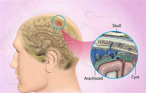 Health Condition : Symptoms, Causes, Treatment and More