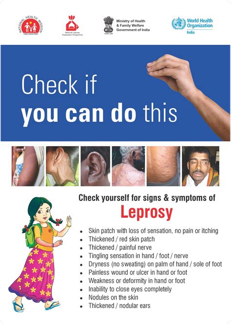 On #WorldLeprosyDay, learn about the signs & symptoms of #leprosy. Remember, if detected early ...