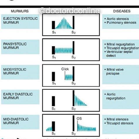 25+ bästa Heart murmur idéerna på Pinterest | Iktus, Farmakologi och Hjärtinfarkt