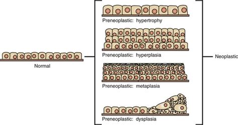 Neoplasia and Tumor Biology | Veterian Key