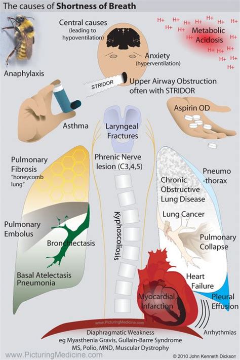 Causes of Shortness of Breath Nursing Labs, Icu Nursing, Nursing Study, Nursing Notes, Surgical ...