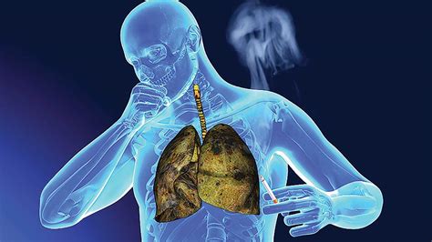 What is the Treatment for Lung Cancer 2023 Updated - Business Listing Blog