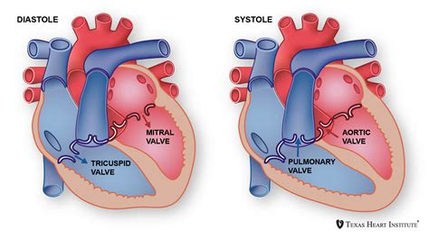 Diseases of the Mitral Valve | Texas Heart Institute