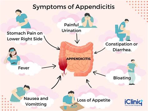 What Is Appendicitis?