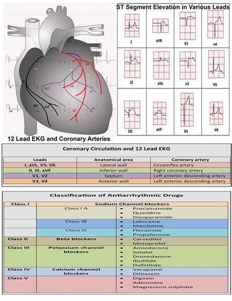 stemi - Google Search | Emergency nursing, Cardiology nursing, Medical knowledge