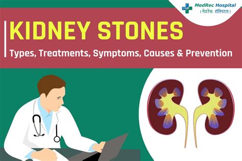 Kidney Stones Explained: Types, Treatments, Symptoms, Causes - Photo ...