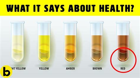 What Does It Mean When Your Urine Is Really Dark Brown - Infoupdate.org